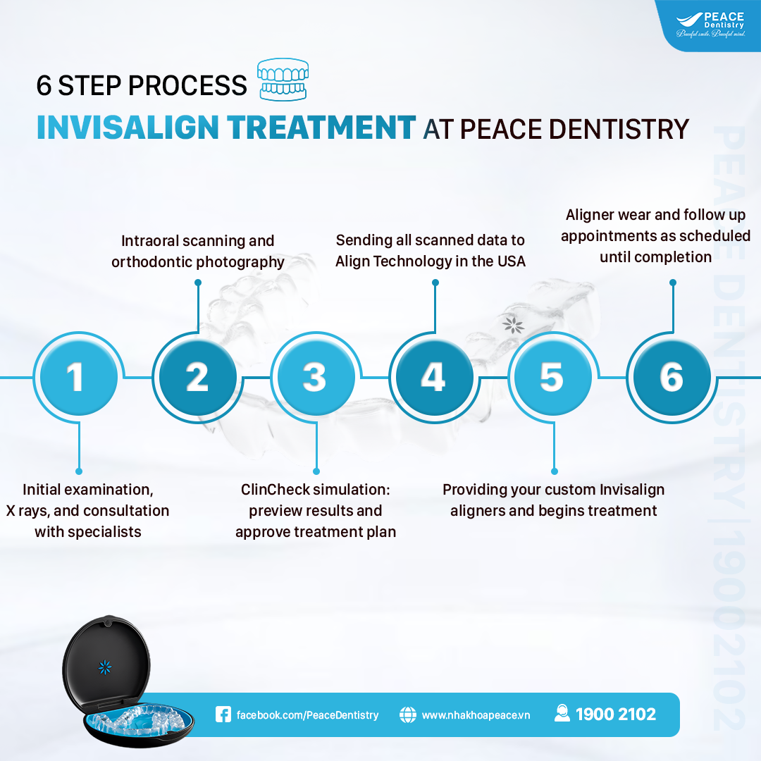 step invisalign