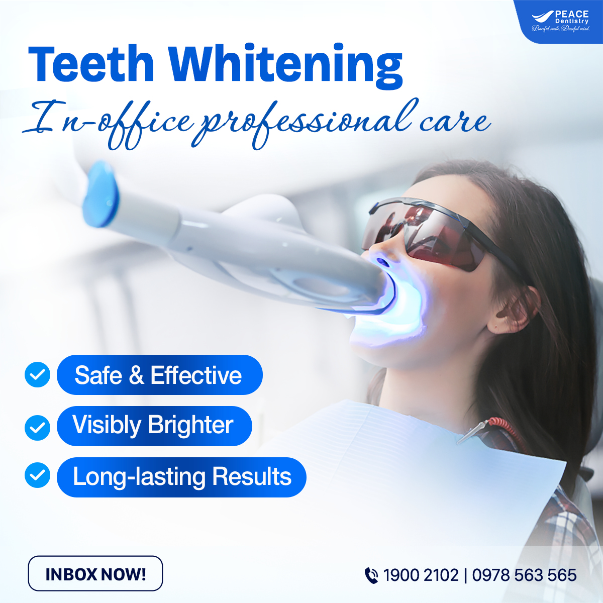 banner tẩy trắng răng